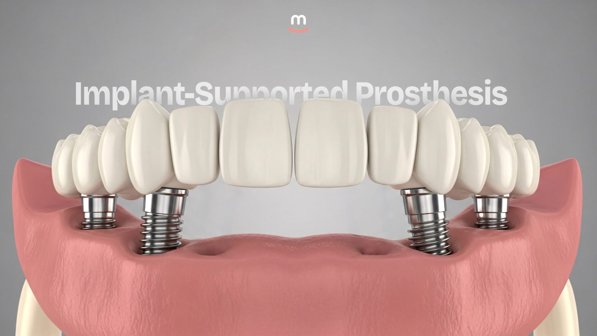 İmplant Destekli Protezler