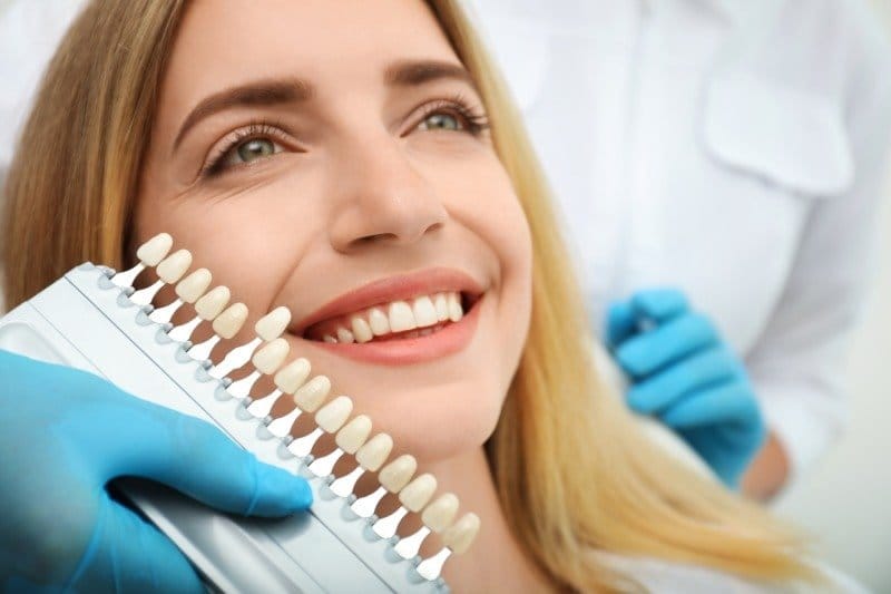 Lamine (Yaprak) Veneer