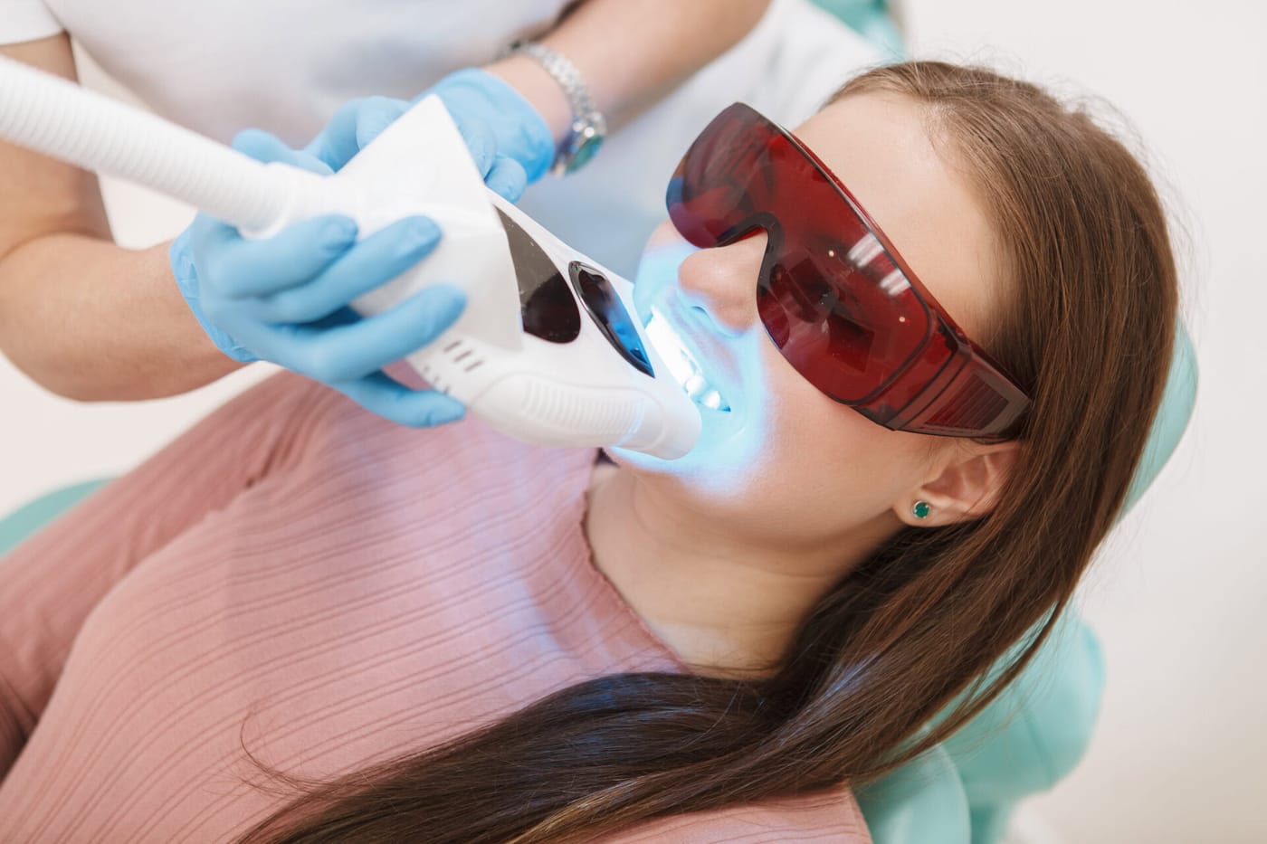 Kırmızı koruyucu gözlüklü hastaya mavi ışıklı klinik beyazlatma cihazı uygulanıyor
