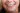 smile makeover i