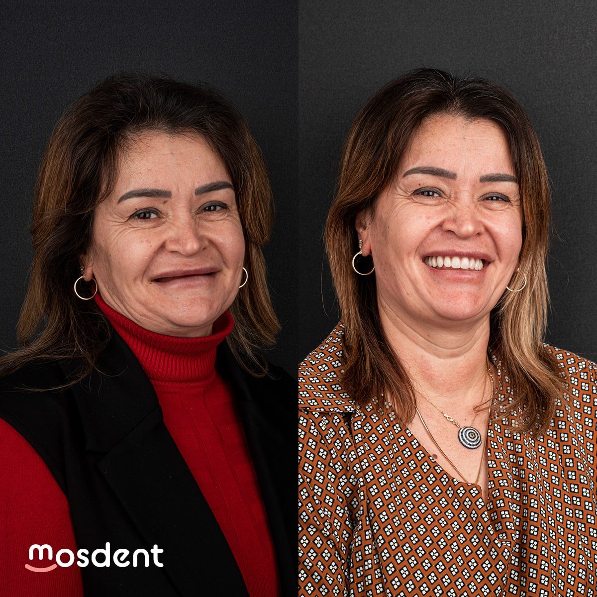 all-on-six-galerry-1