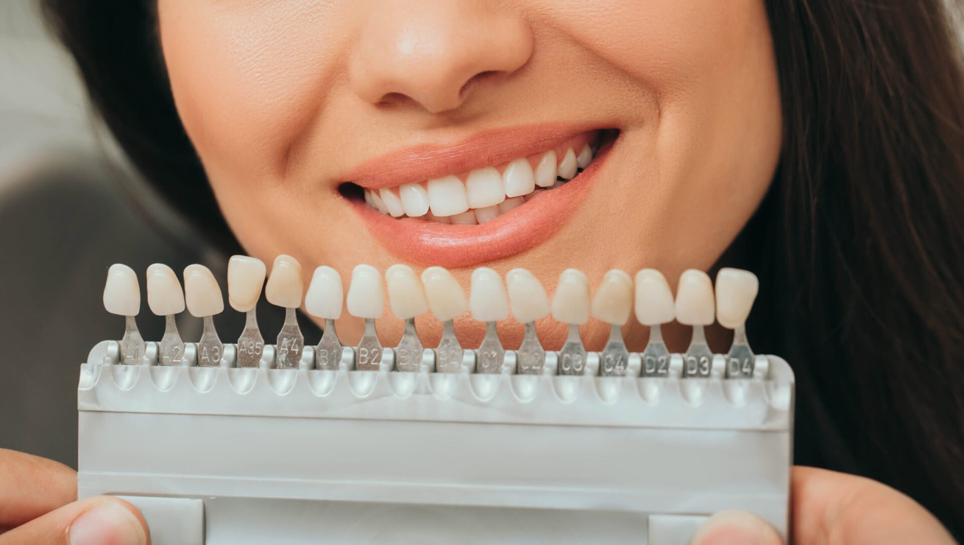 teeth palette with different shades of teeth near female smiling. stomatology, whitening teeth, tooth implant