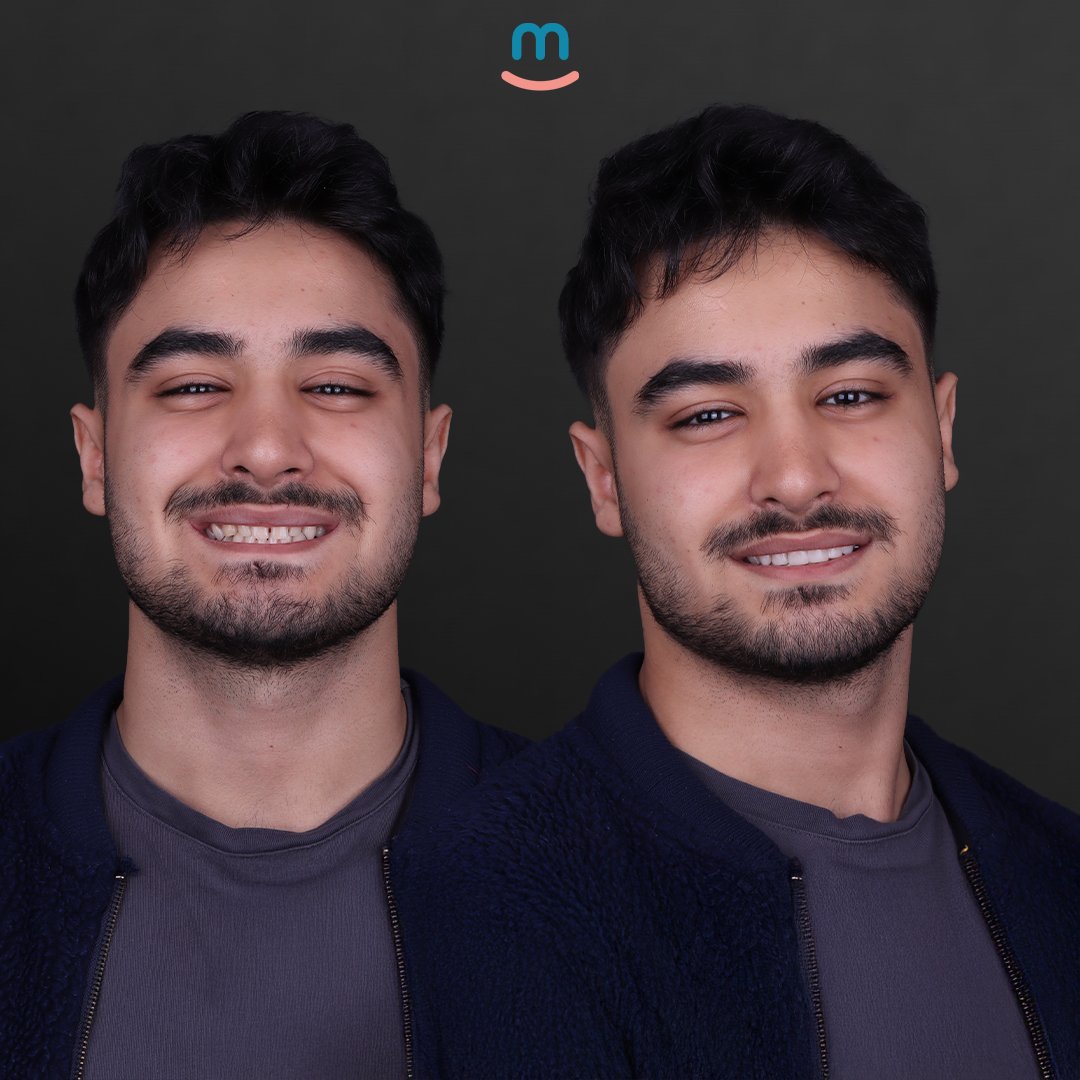 web batuhan karakus 2