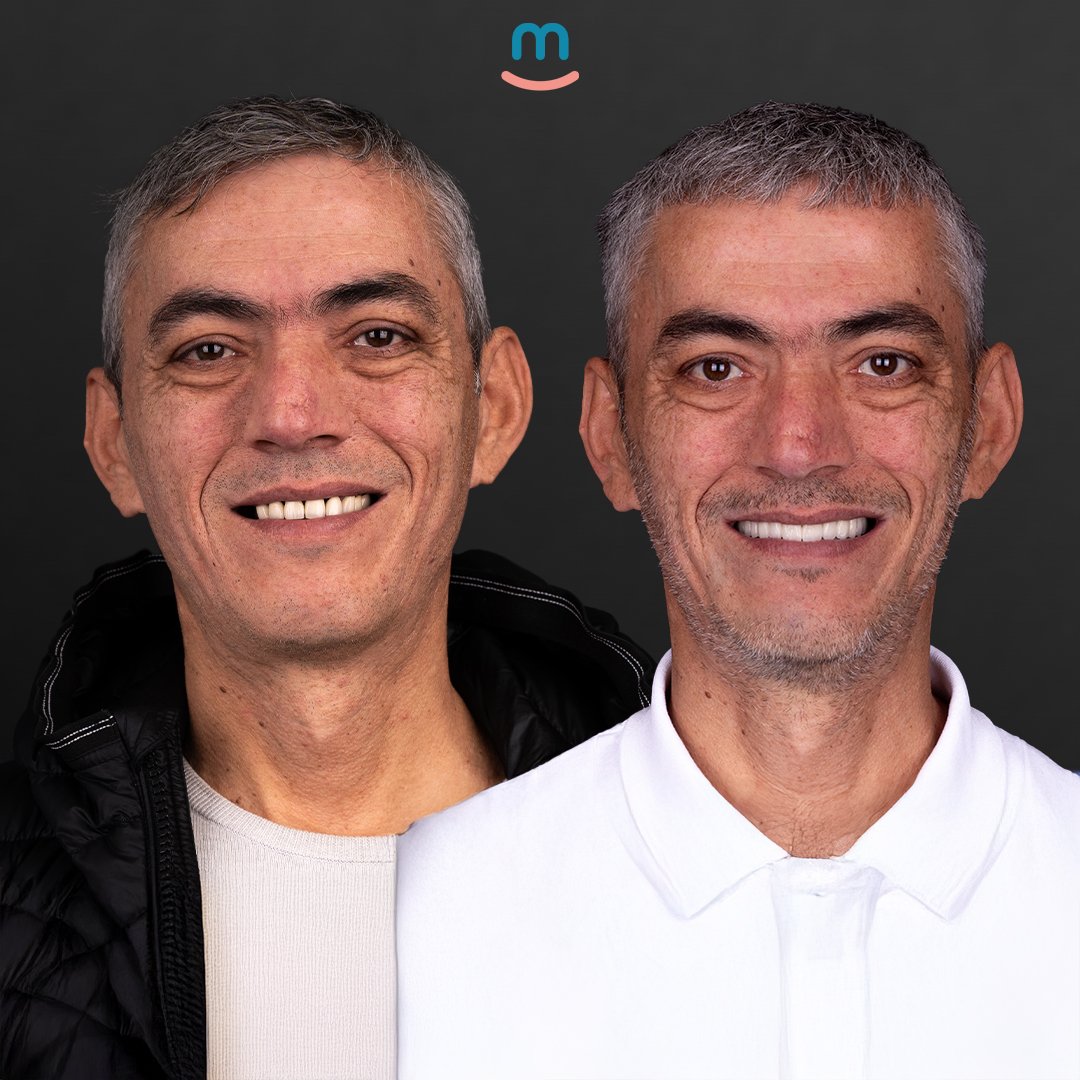 web serkan akıncı 2