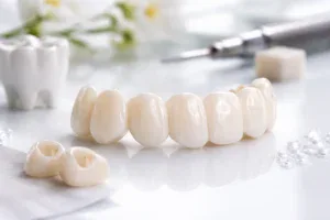 Zirkonya Köprü Nedir?