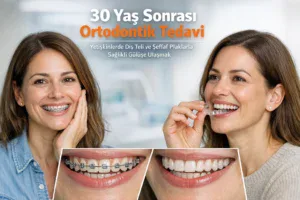 30 Yaş Sonrası Ortodontik Tedavi