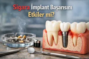 Sigara İmplant Başarısını Etkiler mi?