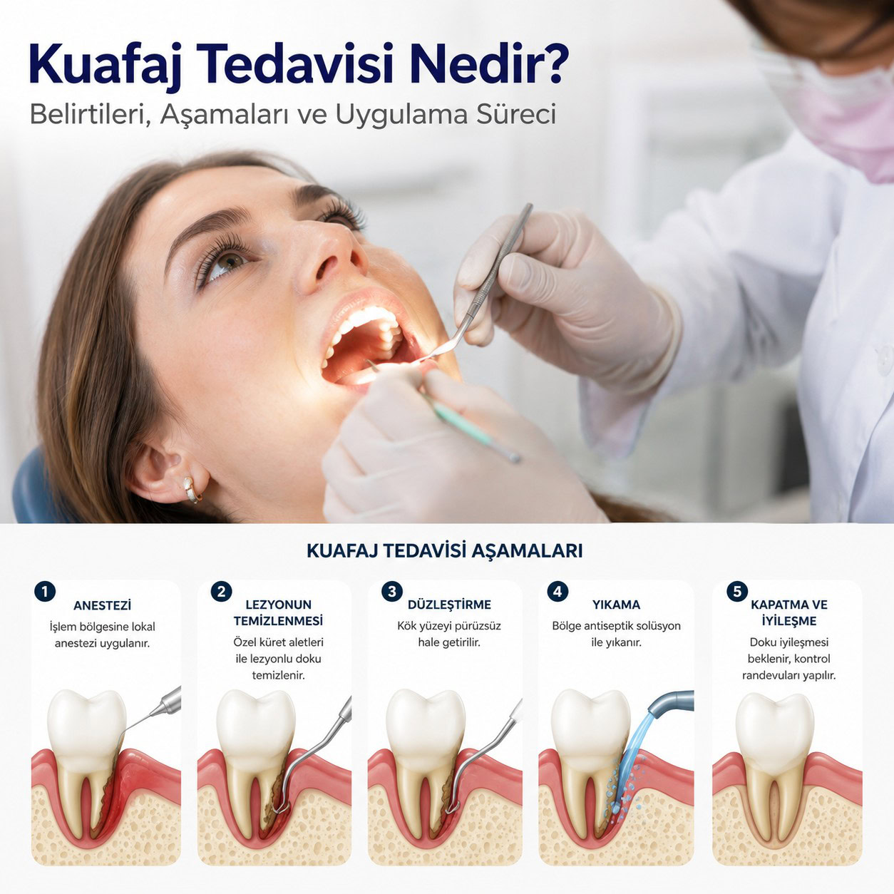 Kuafaj Tedavisi Nedir?