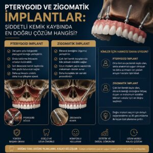 Pterygoid ve Zigomatik İmplantlar: Şiddetli Kemik Kaybında En Doğru Çözüm Hangisi?