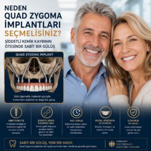 Neden Quad Zygoma İmplantları Seçmelisiniz? Şiddetli Kemik Kaybının Ötesinde Sabit Bir Gülüş